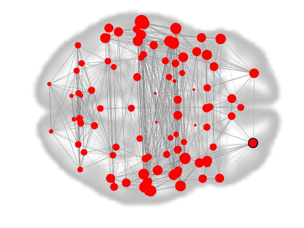 Brain Fingerprint Graphic