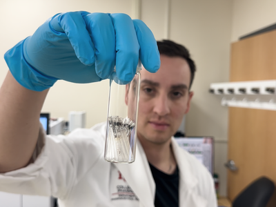 Researchers found higher levels of microplastics in brain tissue than in liver and kidney tissue.