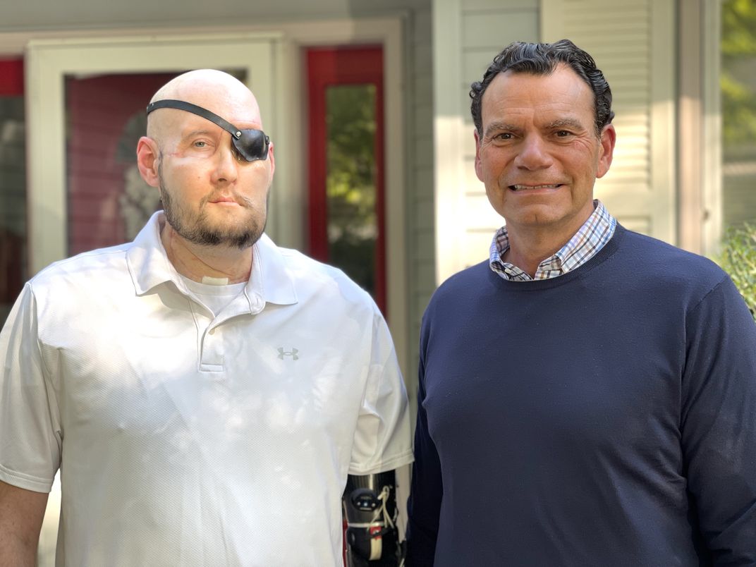 Bald man wearing a black eye patch standing next to a man with dark hair