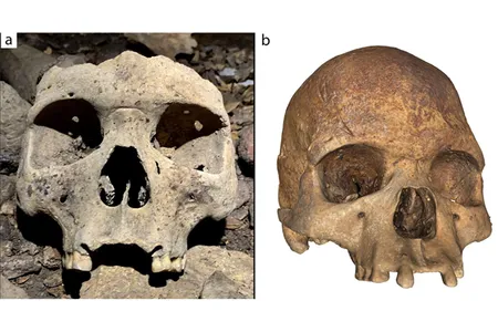 Researchers say the incisors' removal may have served as an indicator of social status or membership in a specific group.