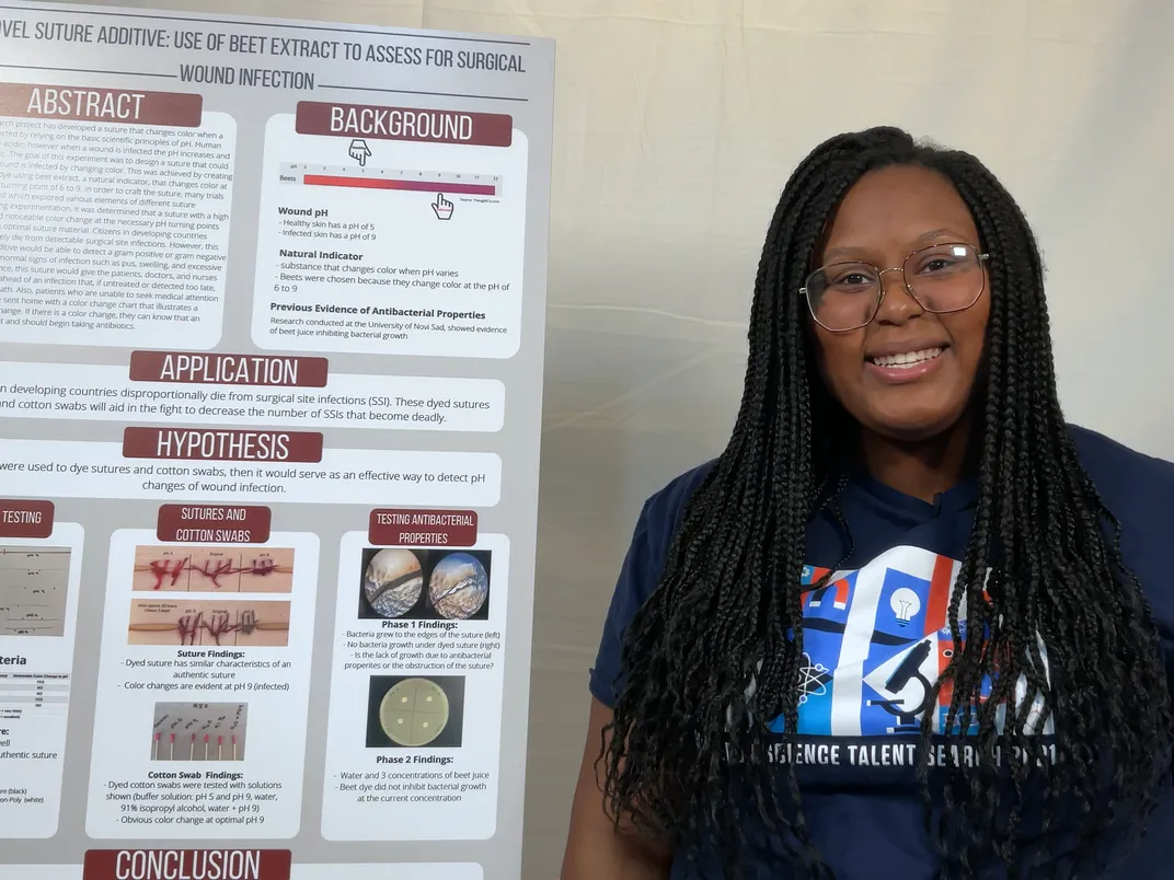 This High Schooler Invented Color-Changing Sutures to Detect Infection