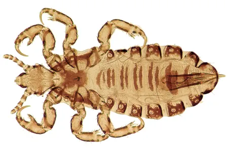 Contact between Europeans and Native Americans is recorded in the DNA of head lice.