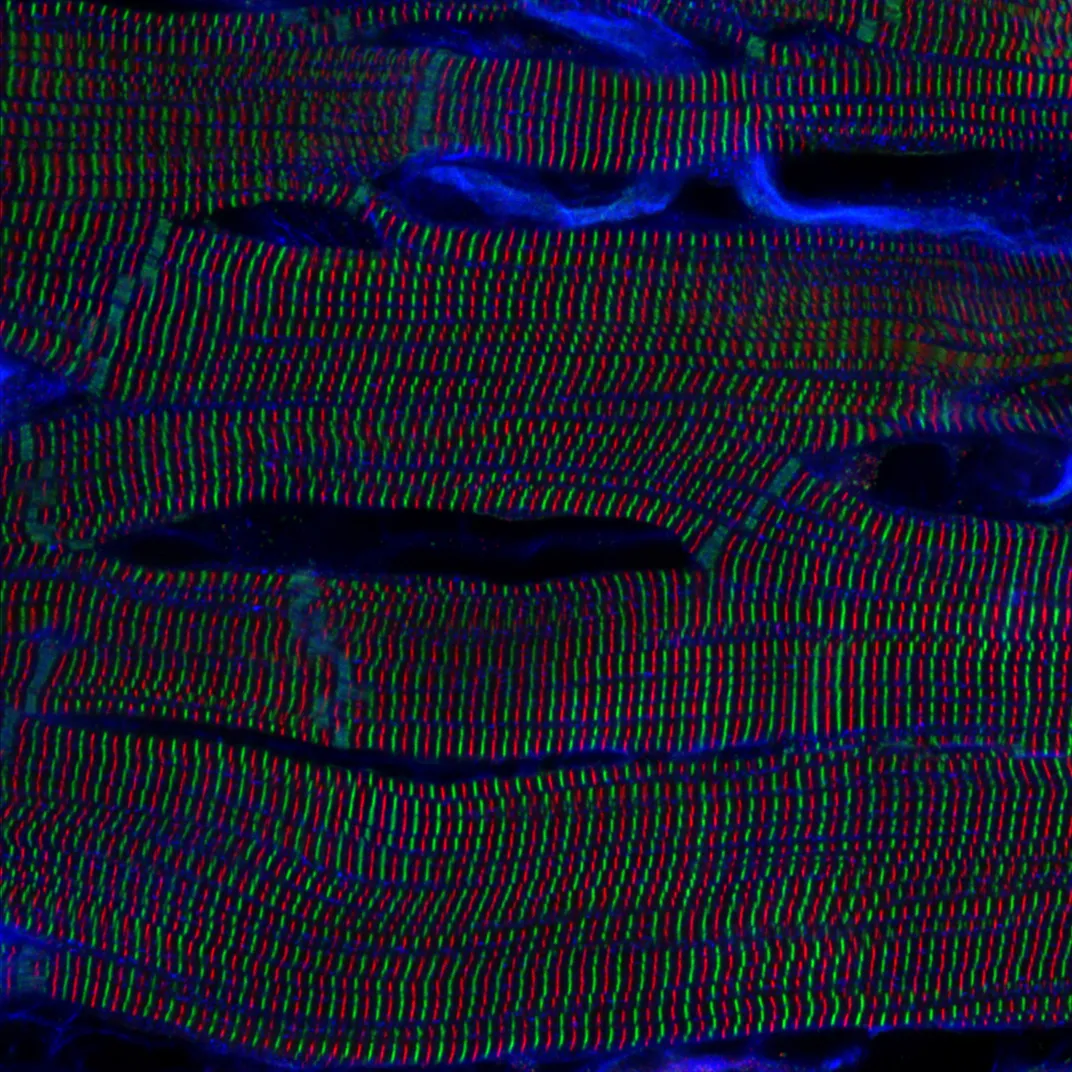 green, red and blue lines form zipper-like structures side to side