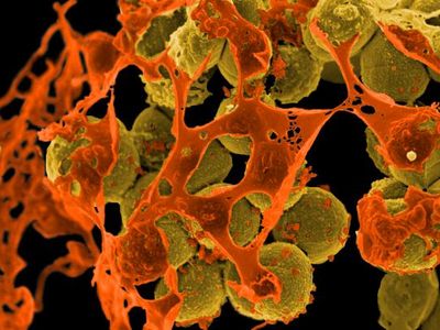 Drug-resistant MRSA bacteria