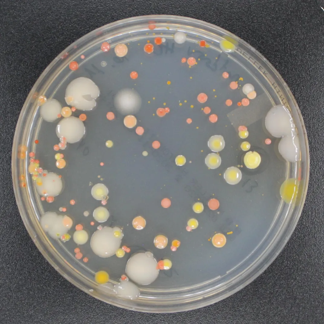 microbes in a petri dish appear as dots colored white, yellow, red and orange