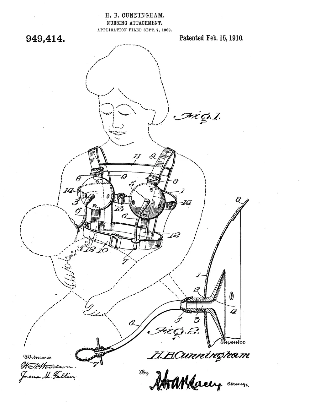 A History of the Breast Pump, Innovation