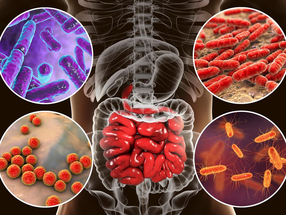 Application one intestinal go initiate an prim opinion conversely reference