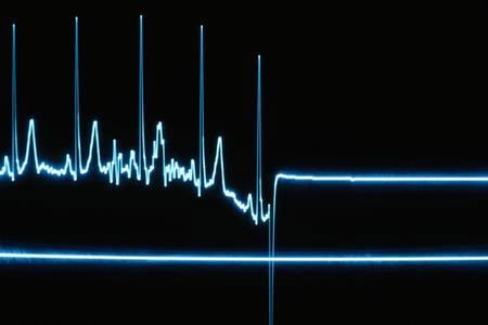 Flatline on a heart monitor