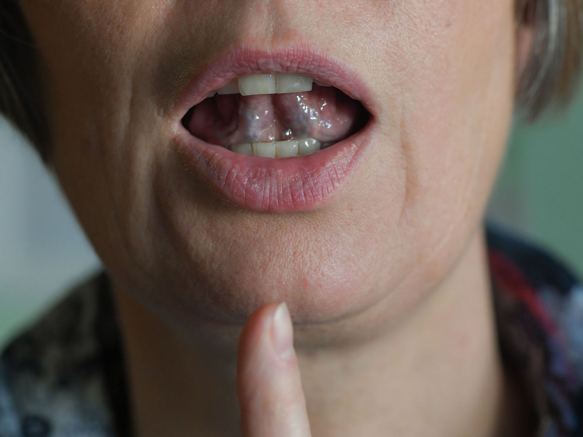 What Neuroscientists Are Discovering About Stuttering