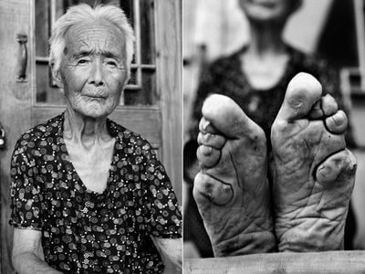 Zhao Hua Hong is one of the last living foot-binding practitioners. 