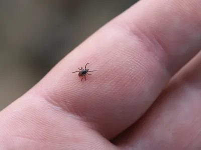 The First At-Home Test for Infected Ticks Could Improve Lyme Disease Diagnosis image