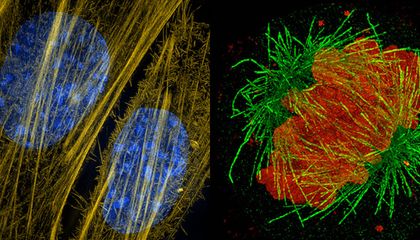 These Super-Resolution Microscopes Are Revealing the Inner Lives of Cells
