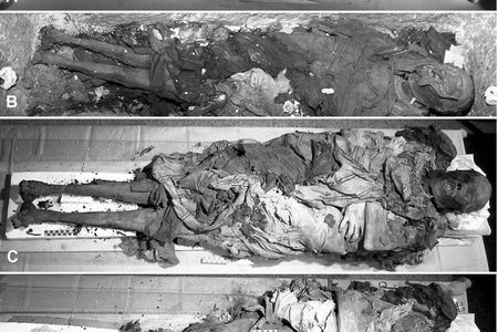 Researchers exhumed the mummy of Cangrande della Scala in 2004 to perform a modern autopsy on the famous Italian autocrat. 
