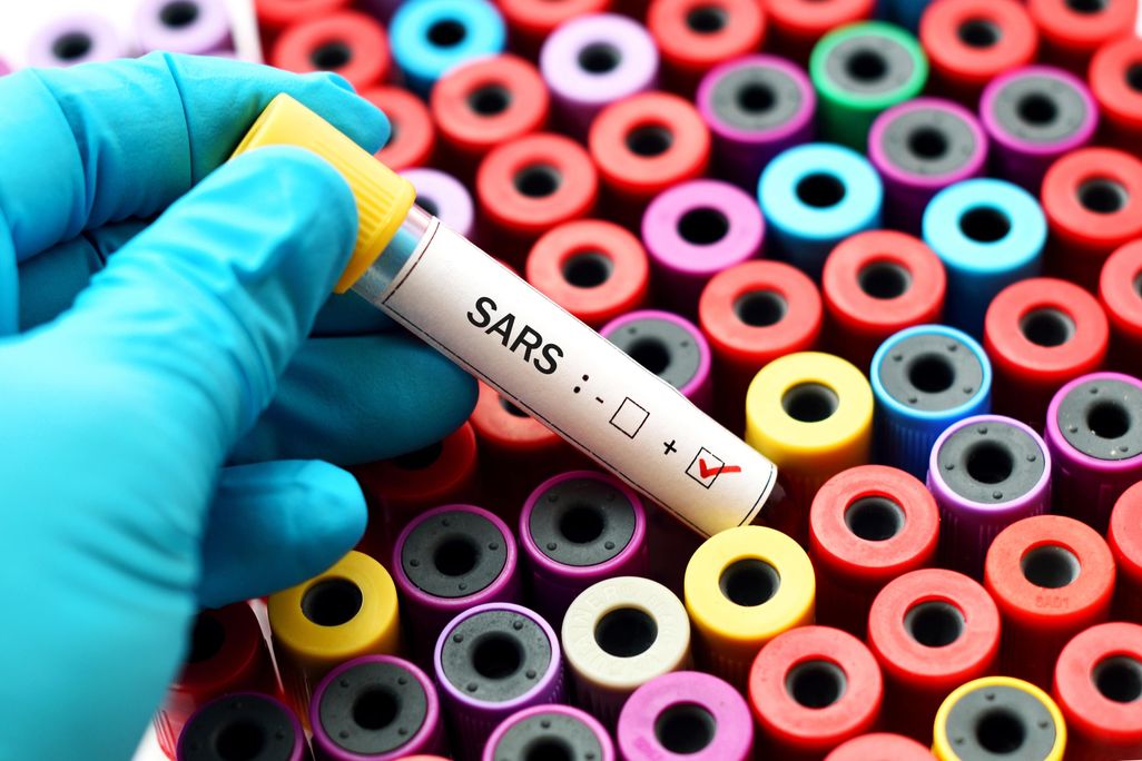 SARS