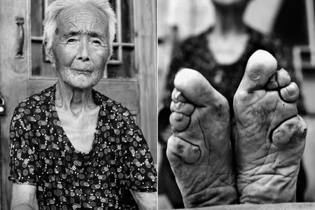 Zhao Hua Hong is one of the last living foot-binding practitioners. 