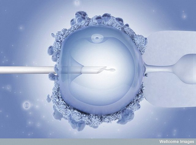 GLANEY TAKE the TRIPP/A Test Tube Baby 【公式通販】