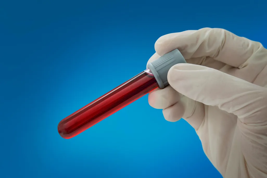 Blood Tube