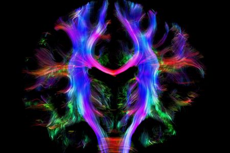 This psychedelic form is actually a map of pathways inside a human brain. The different colors show the ways various parts of the brain communicate—left with right sides in red, front with back in green, and the brain to the rest of the body in blue.