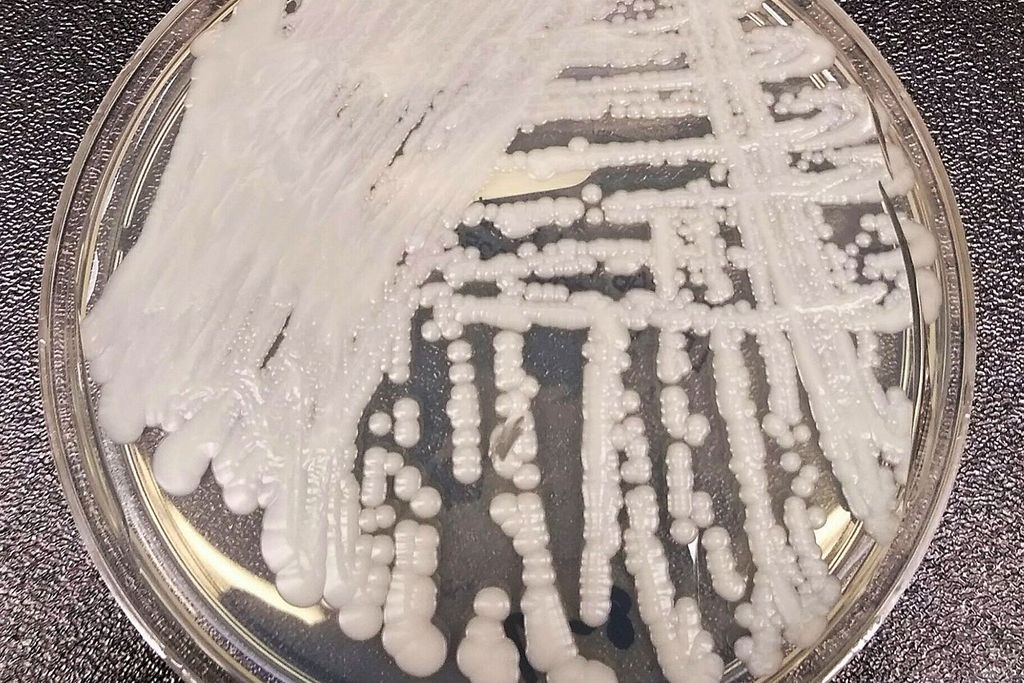 An upclose photo of a petri dish innoculated with <i>C. auris<i/>