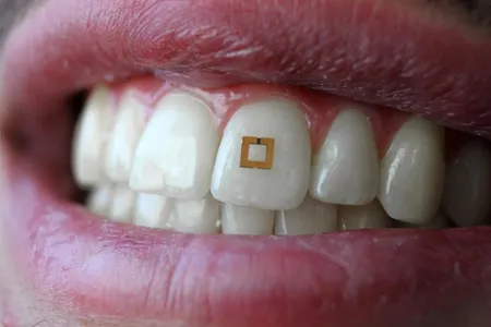 Tooth-mounted sensor