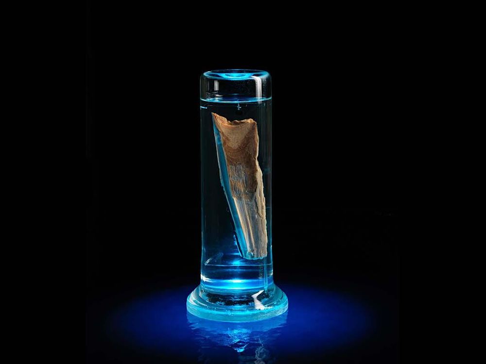 For Scientists, Chunks of Whale Earwax Can Be Biological Treasure Troves