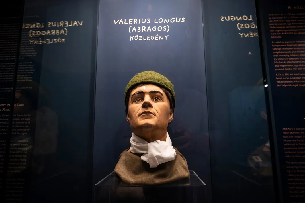 Facial reconstruction