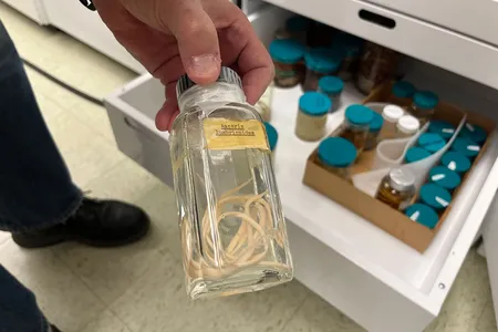 A jar containing Ascaris, a parasitic worm that affects over one billion people worldwide