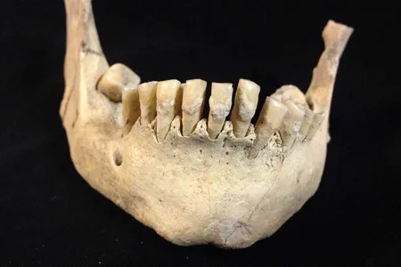 Archaeologists found traces of a milk protein in seven prehistoric Britons' calcified dental plaque