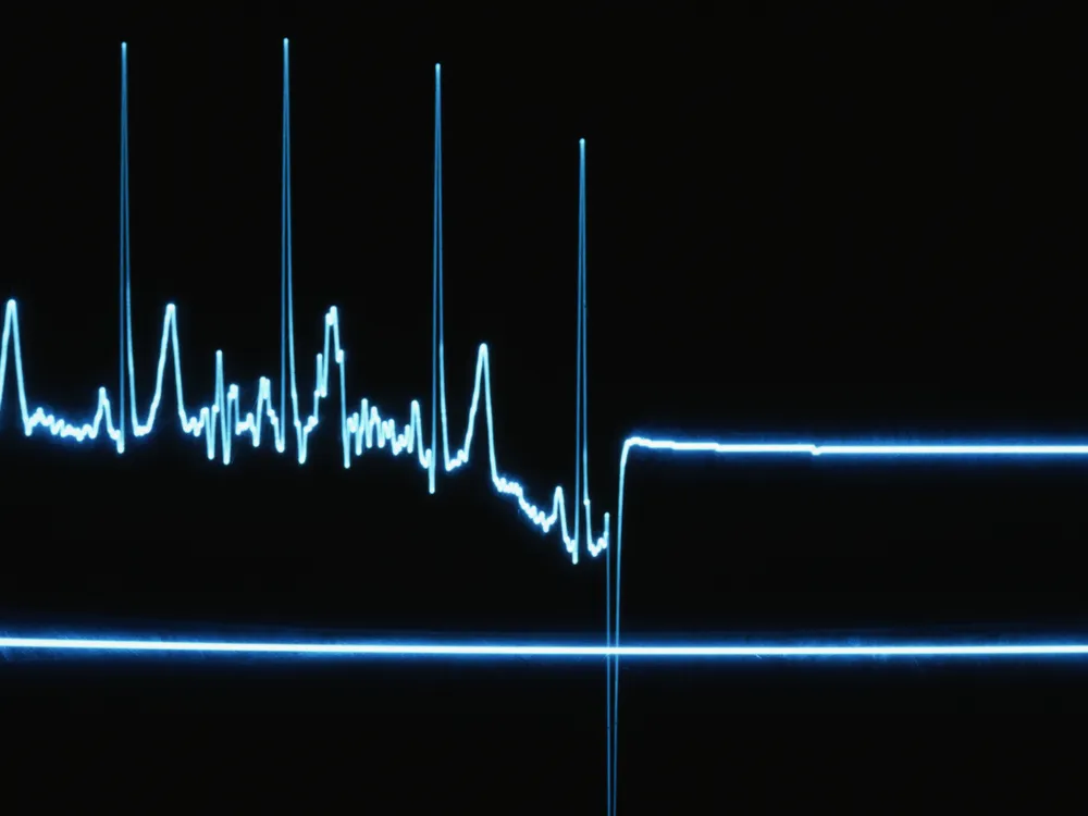 Flatline on a heart monitor