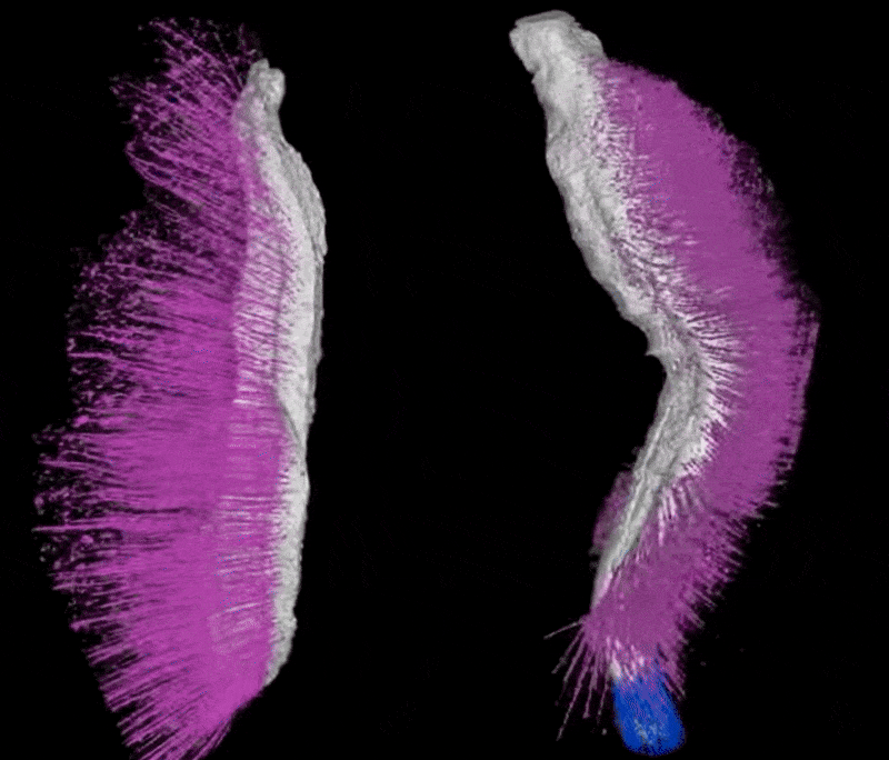 gif of two spiky-looking worms