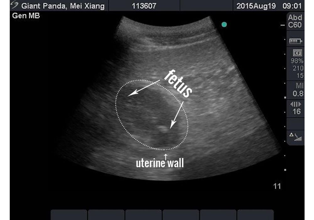Mei Xiang's ultrasound
