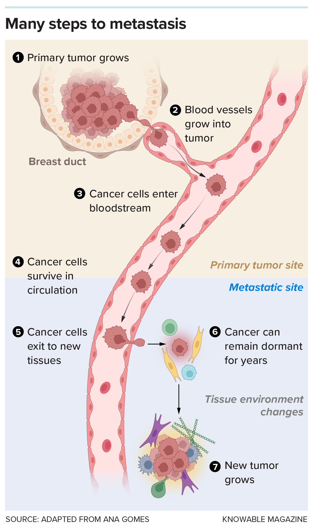 Metastasis Graphic