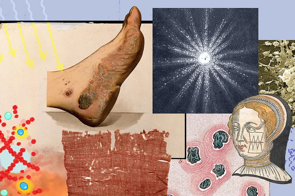 light-nano-wound-1600x600.jpg