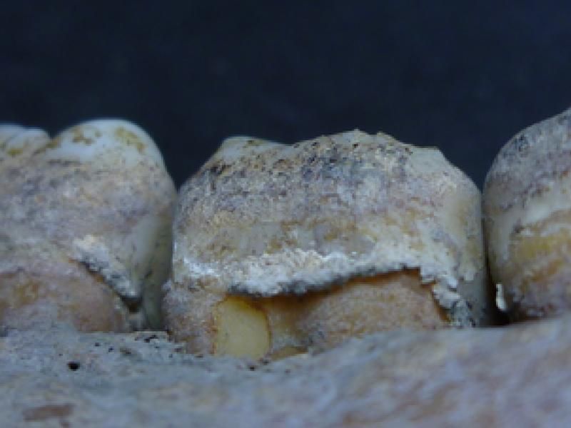 Teeth