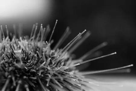 “The white sea urchin (Lytechinus pictus) is found below the tide line,” writes marine biology graduate student Julia Notar in her submission. “I study how these animals see, and what they can see. They usually live in flat, sandy areas, where there aren't many places to hide from fish predators. Different species of sea urchins, which live in rocky areas, usually hide from fish in dark crevices in, between, or under rocks. Those urchins can use their blurry, but still useful vision to find those hiding spots. Does this species, which doesn't live in an environment with many hiding spots, do the same thing?”