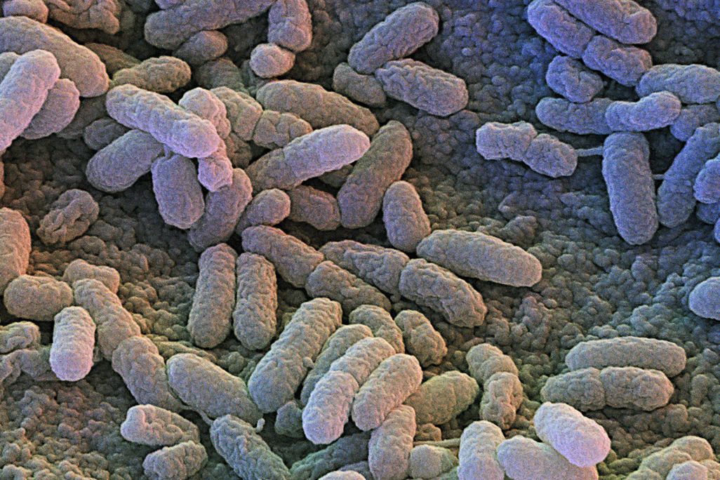 07_31_2014_salmonella.jpg