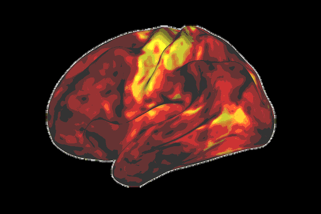 A brain with different areas highlighted