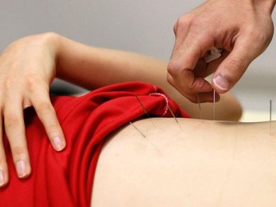 A South Korean athlete receives acupuncture treatment