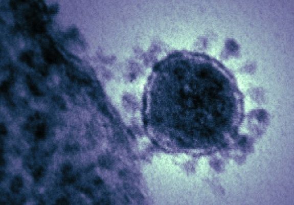 An electron micrograph of the coronavirus.