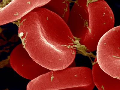 Red blood cells imaged by a scanning electron microscope. 