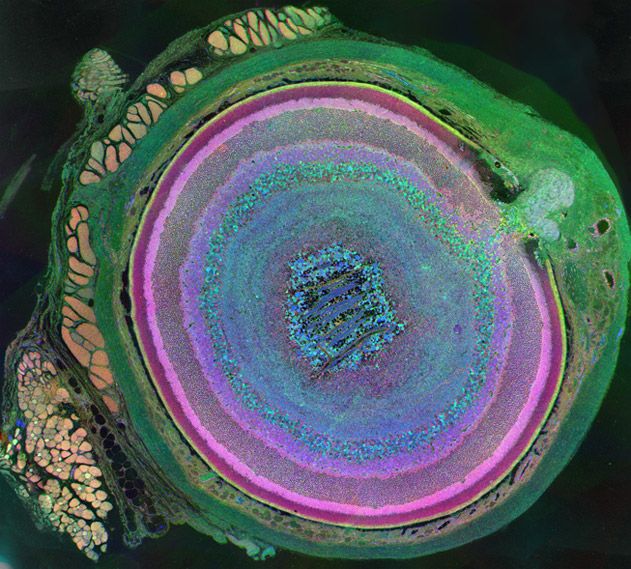 The Metabolomic Eye