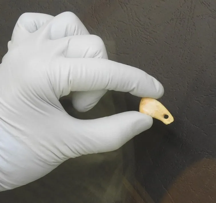 Gloved hand holding a tooth with a hole drilled through it