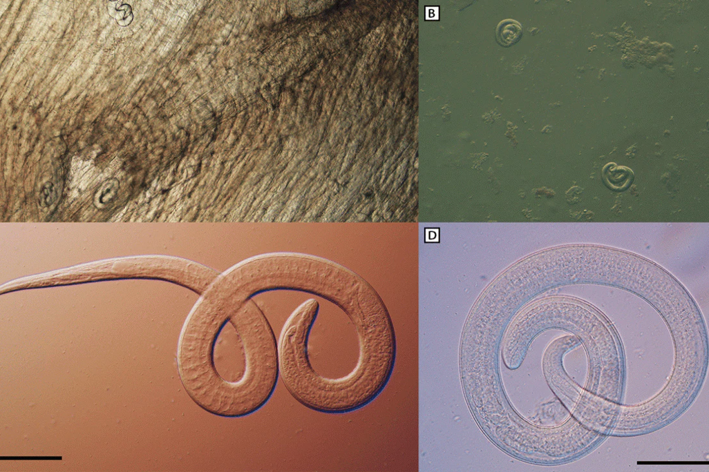 Close-up view of little worms under a microscope