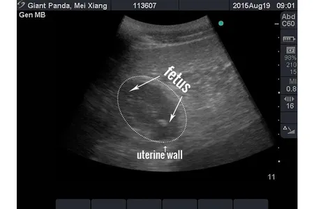 Veterinarians detected what they believe is a developing giant panda fetus in an ultrasound procedure on giant panda Mei Xiang. Based on the size of the fetus, which is about four centimeters, officials say that Mei Xiang could give birth early next week, or possibly in early September.