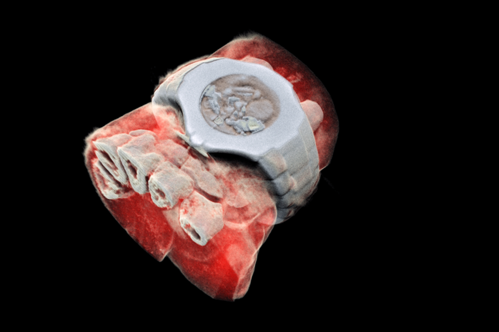 Bioimaging Wrist
