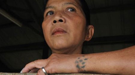 Another medicinal tattoo of the Kayan