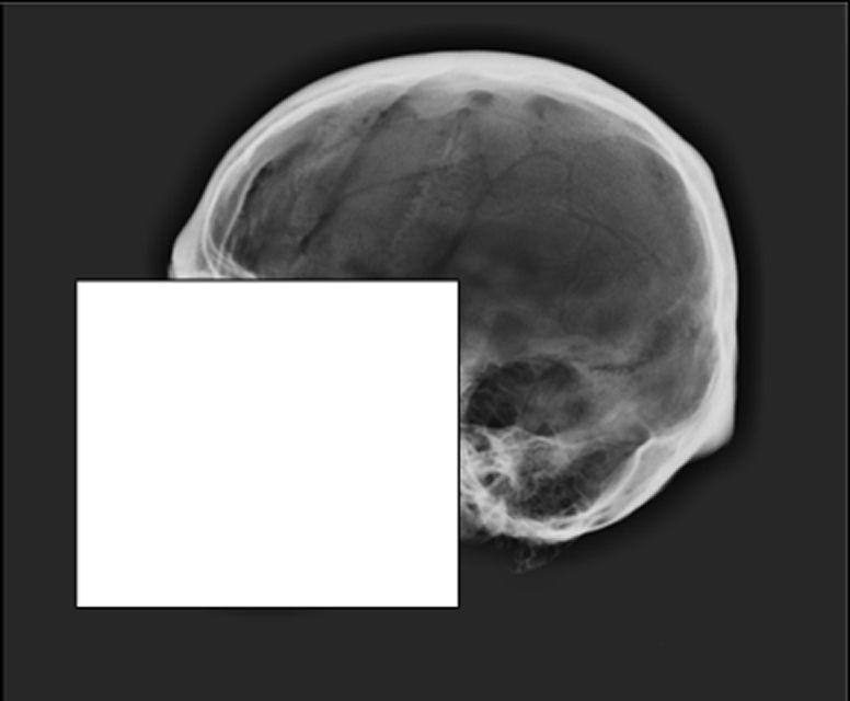 Skull release image