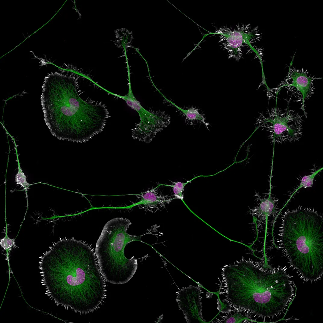 Green and pink blobs against black background