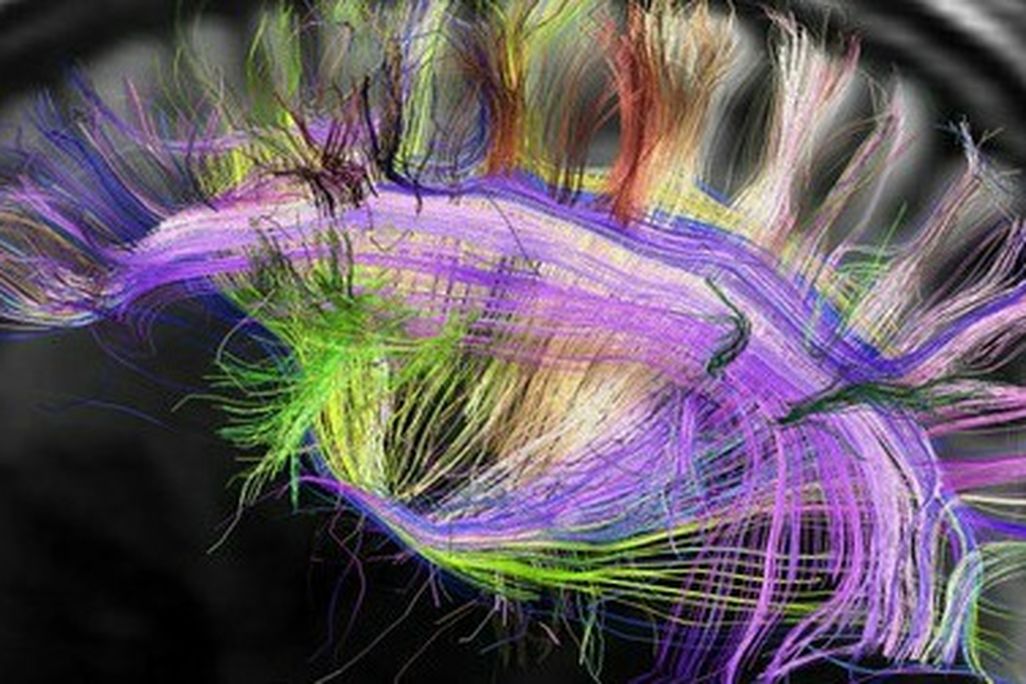 The brain is more grid than tangle of spaghetti.