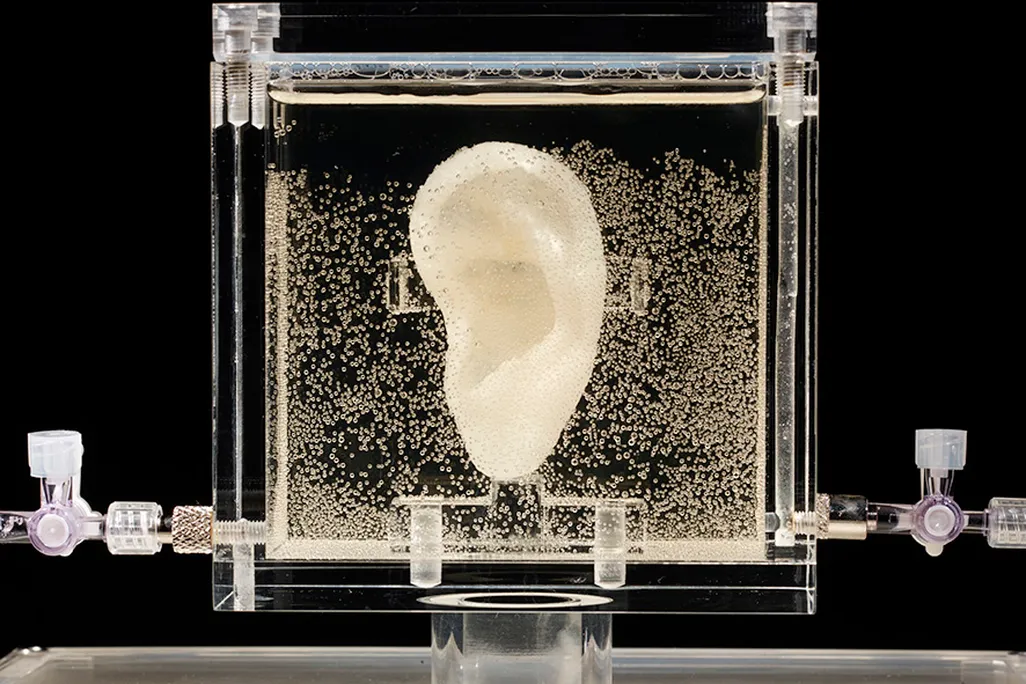 Vincent van Gogh Ear
